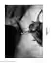 Fig. 28 - Encapsulated liver tissue