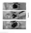 Fig. 31 - Encapsulated liver tissue