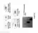 Fig. 41 - Encapsulated liver tissue