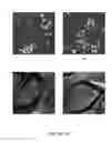 Fig. 02 - EPITHELIAL TUMOR CELL CULTURES