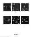 Fig. 05 - EPITHELIAL TUMOR CELL CULTURES
