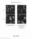 Fig. 12 - EPITHELIAL TUMOR CELL CULTURES