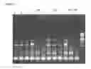 Fig. 04 - METHODS OF DEPLETING OR ISOLATING TARGET RNA FROM A NUCLEIC ACID SAMPLE