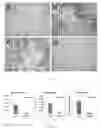 Fig. 14 - Compositions and methods for inhibiting gene expression of alpha-1 AntiTrypsin