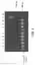 Fig. 04 - Plasmid vector for expressing a PVT1 exon and method for constructing standard curve therefor
