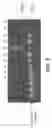 Fig. 07 - Plasmid vector for expressing a PVT1 exon and method for constructing standard curve therefor