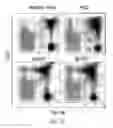 Fig. 15 - Methods of treating or preventing pyruvate kinase deficiency