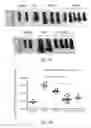 Fig. 18 - Methods of treating or preventing pyruvate kinase deficiency