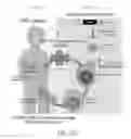 Fig. 38 - Methods of treating or preventing pyruvate kinase deficiency