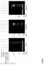 Fig. 15 - Compositions and methods for rapid in vitro synthesis of bioconjugate vaccines in vitro via production and N-glycosylation of protein carriers in detoxified prokaryotic cell lysates