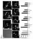 Fig. 02 - RETINAL GANGLION CELL SUBTYPE DIFFERENTIATION FROM HUMAN PLURIPOTENT STEM CELLS