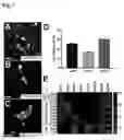 Fig. 04 - RETINAL GANGLION CELL SUBTYPE DIFFERENTIATION FROM HUMAN PLURIPOTENT STEM CELLS
