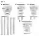 Fig. 07 - RETINAL GANGLION CELL SUBTYPE DIFFERENTIATION FROM HUMAN PLURIPOTENT STEM CELLS
