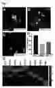 Fig. 08 - RETINAL GANGLION CELL SUBTYPE DIFFERENTIATION FROM HUMAN PLURIPOTENT STEM CELLS