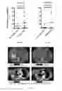 Fig. 14 - Methods and Systems for Predicting Response to Immunotherapies for Treatment of Cancer
