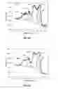 Fig. 16 - Surface treatment process
