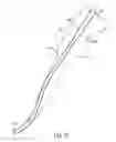 Fig. 17 - ENDODONTIC INSTRUMENTS AND METHODS OF MANUFACTURING THEREOF