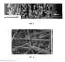 Fig. 04 - MULTI LAYER SCAFFOLD DESIGN WITH SPACIAL ARRANGEMENT OF CELLS TO MODULATE TISSUE GROWTH