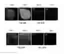 Fig. 10 - MULTI LAYER SCAFFOLD DESIGN WITH SPACIAL ARRANGEMENT OF CELLS TO MODULATE TISSUE GROWTH