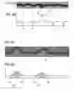 Fig. 14 - Seam inspection device