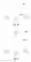 Fig. 11 - NODE ELEMENTS, KITS, AND METHODS