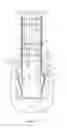 Fig. 12 - Embedded post base