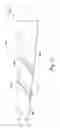 Fig. 05 - SUPPLEMENTAL DOOR LOCK AND BREACH TOOL