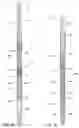 Fig. 09 - Downhole casing pulling tool