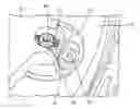Fig. 01 - Torque button lock clip