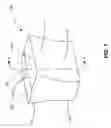 Fig. 07 - Endless drive arrangement and tensioning system for same