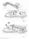 Fig. 05 - Suction oil filter for a transmission or combustion engine