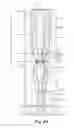 Fig. 07 - Valve system in an injection molding system