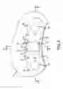 Fig. 04 - Spacer and sensor module for detecting a vibrational behavior of a mechanical component including the spacer