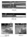Fig. 03 - Methods, systems, arrangements and computer-accessible medium for providing micro-optical coherence tomography procedures