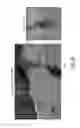 Fig. 07 - Methods, systems, arrangements and computer-accessible medium for providing micro-optical coherence tomography procedures