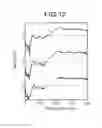 Fig. 08 - Parameter estimation method and parameter estimation device