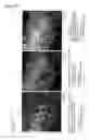 Fig. 05 - Cancer test device, cancer test method, and staining agent for use in cancer test