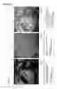 Fig. 06 - Cancer test device, cancer test method, and staining agent for use in cancer test