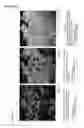 Fig. 07 - Cancer test device, cancer test method, and staining agent for use in cancer test
