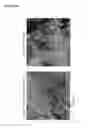 Fig. 10 - Cancer test device, cancer test method, and staining agent for use in cancer test