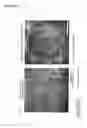 Fig. 13 - Cancer test device, cancer test method, and staining agent for use in cancer test