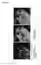Fig. 17 - Cancer test device, cancer test method, and staining agent for use in cancer test