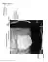 Fig. 31 - Cancer test device, cancer test method, and staining agent for use in cancer test