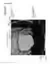 Fig. 32 - Cancer test device, cancer test method, and staining agent for use in cancer test