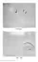 Fig. 07 - Systems and methods to identify and treat subjects at risk for obstetrical complications