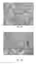 Fig. 14 - Systems and methods to identify and treat subjects at risk for obstetrical complications