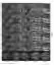 Fig. 07 - Noise suppression for wave-CAIPI
