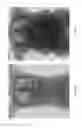 Fig. 05 - Method and apparatus for dynamic dose estimation and ionizing radiation source adjustment