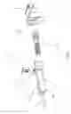 Fig. 10 - Elastic hinge for eyeglasses