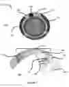 Fig. 02 - OPHTHALMIC DEVICES INCORPORATING PHOTONIC ELEMENTS